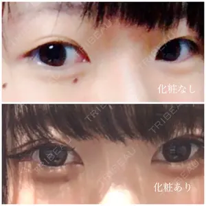 before image