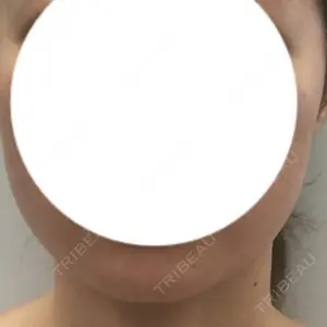before image