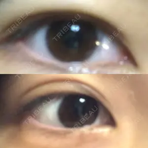 before image