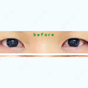 before image