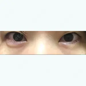 before image