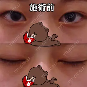 before image