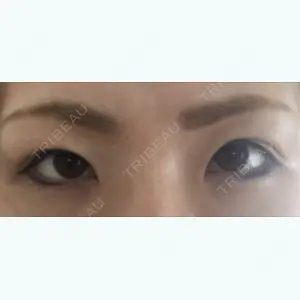 before image