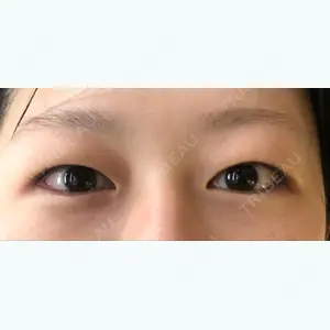 before image