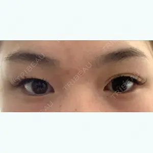 before image