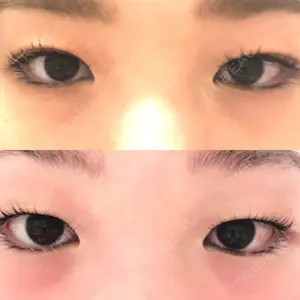 銀座高須クリニックの入谷 英里医師口コミ