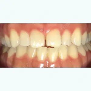 before image