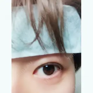 before image