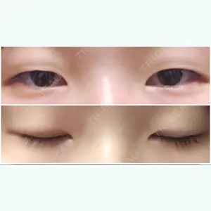 before image