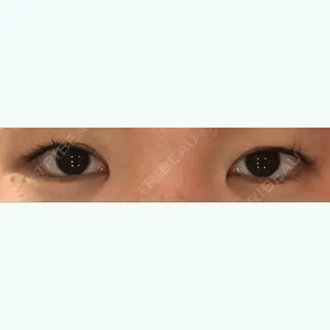 before image