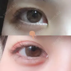 before image