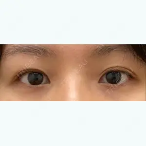 before image