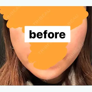 before image