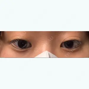 before image