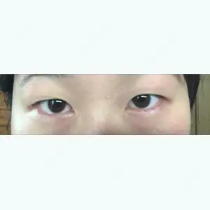 before image