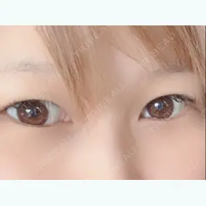 before image