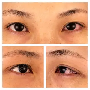before image