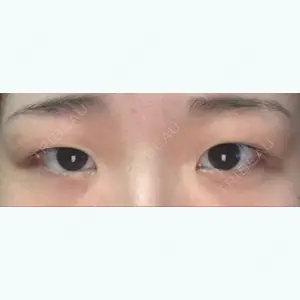 before image