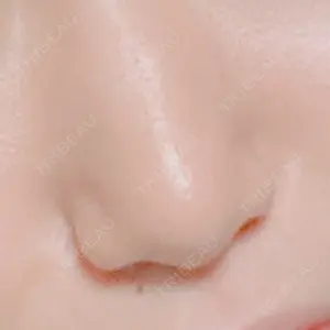before image