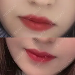 TCB東京中央美容外科 TCB東京中央美容外科 堺院口コミ