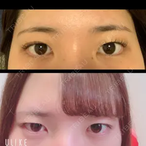 before image