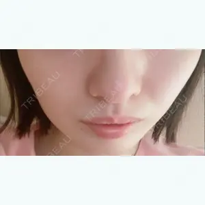 口コミ