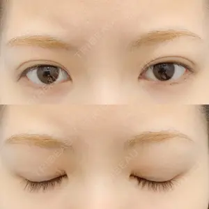 before image