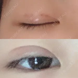 before image