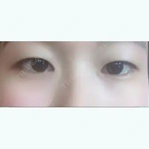 before image