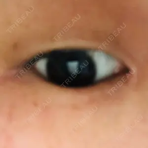 before image