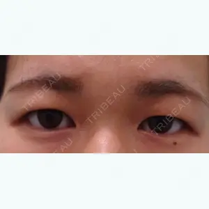 before image