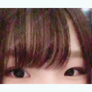 before image
