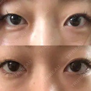 before image