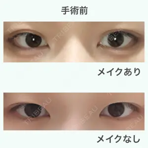 before image