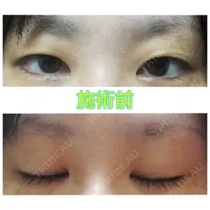 before image