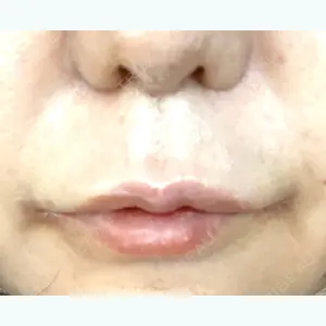 before image