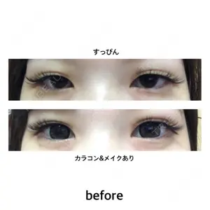 before image