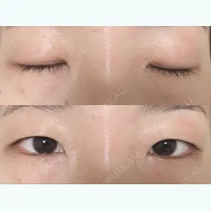 before image