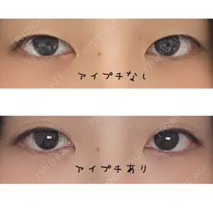 before image