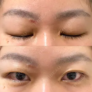 before image