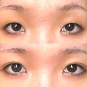 before image