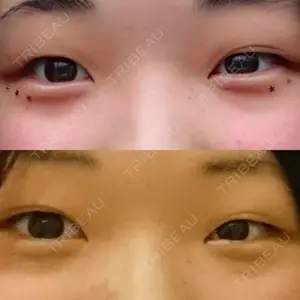 before image