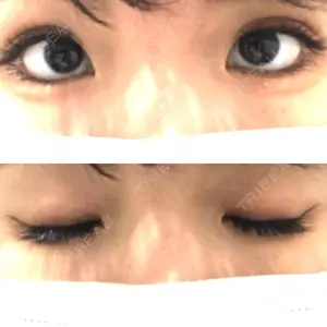 湘南美容クリニック 湘南美容クリニック赤坂見附院口コミ