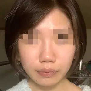 before image