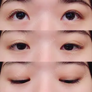 口コミ