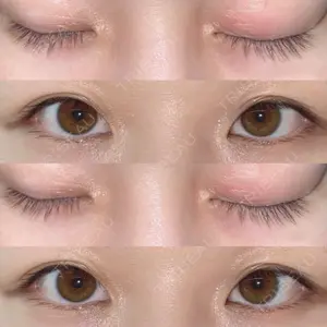 before image