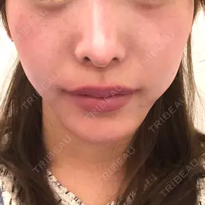 湘南美容クリニック 池袋東口院の田中 龍二医師口コミ
