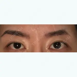 before image