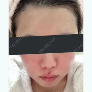 before image