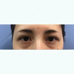 before image